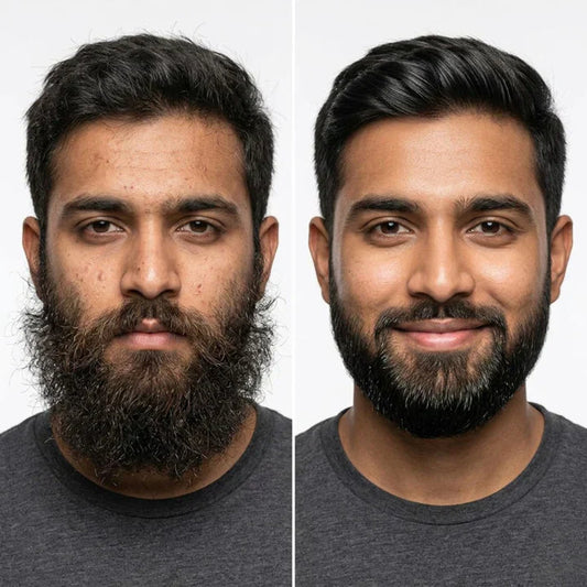 (Buy 1 Get 1 Free)Dr. Alies Beard Growth Oil.