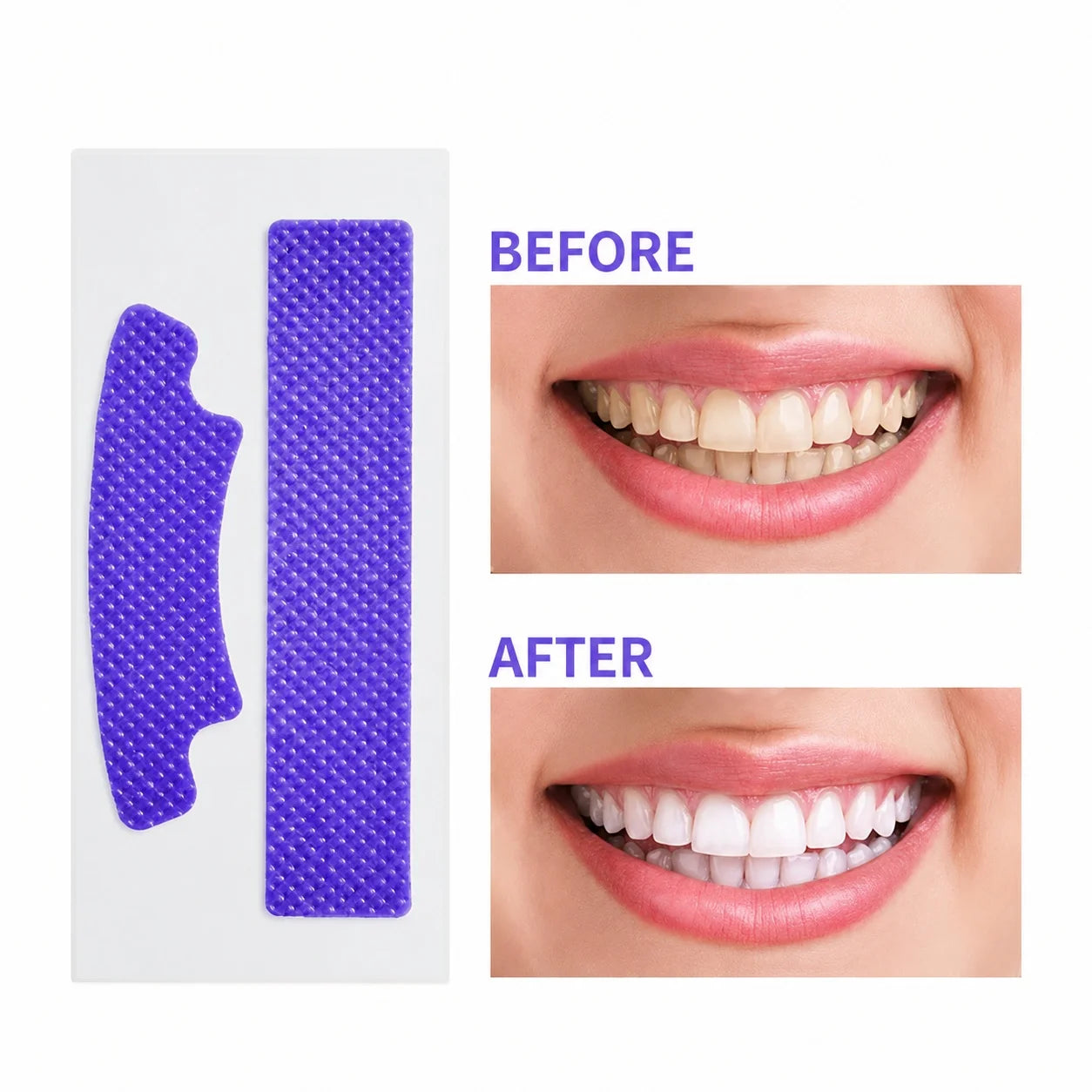 7 In 1 Purple Teeth Whitening Strips.